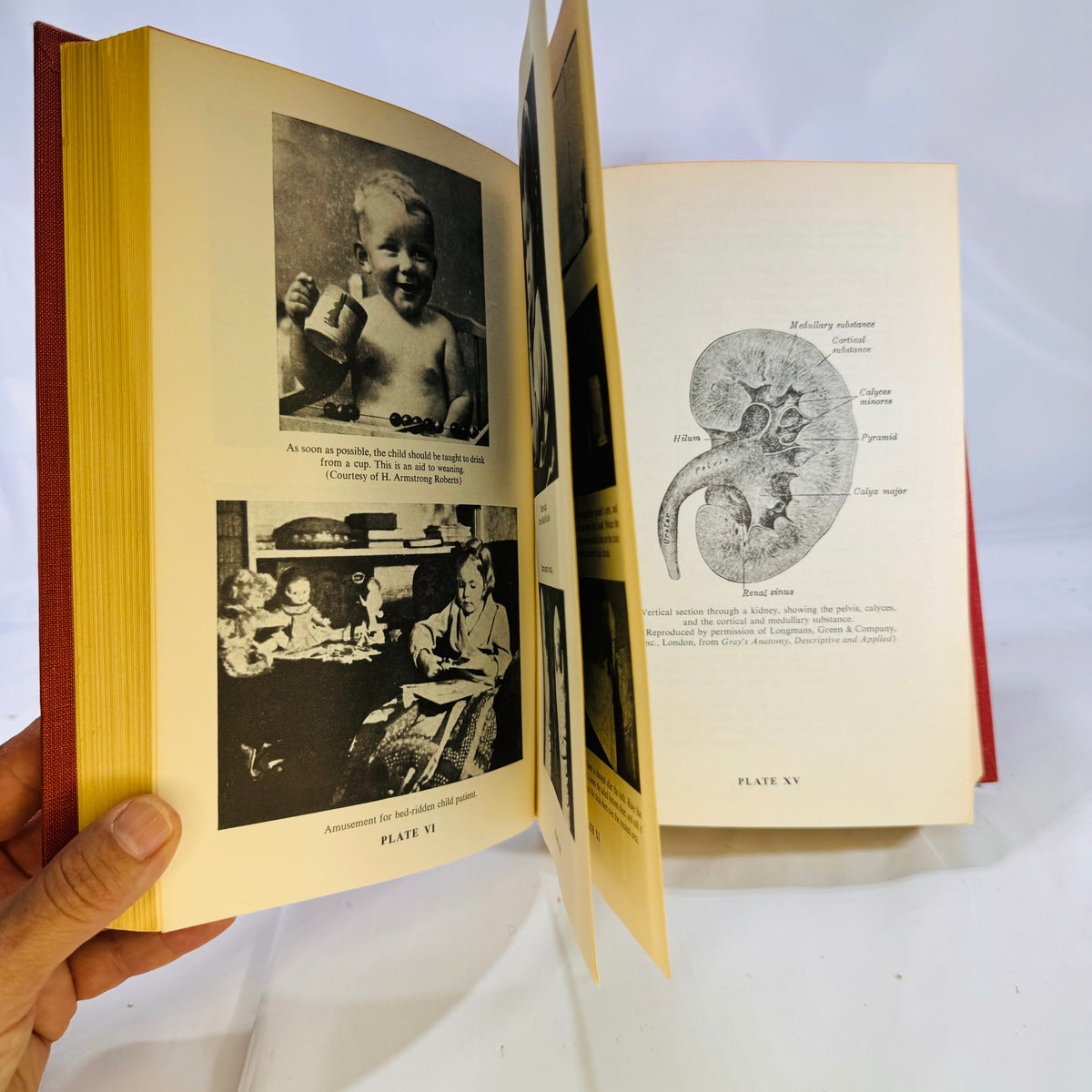 Modern Medical Adviser edited by Morris Fishbein, MD 1961 Garden City Publishers