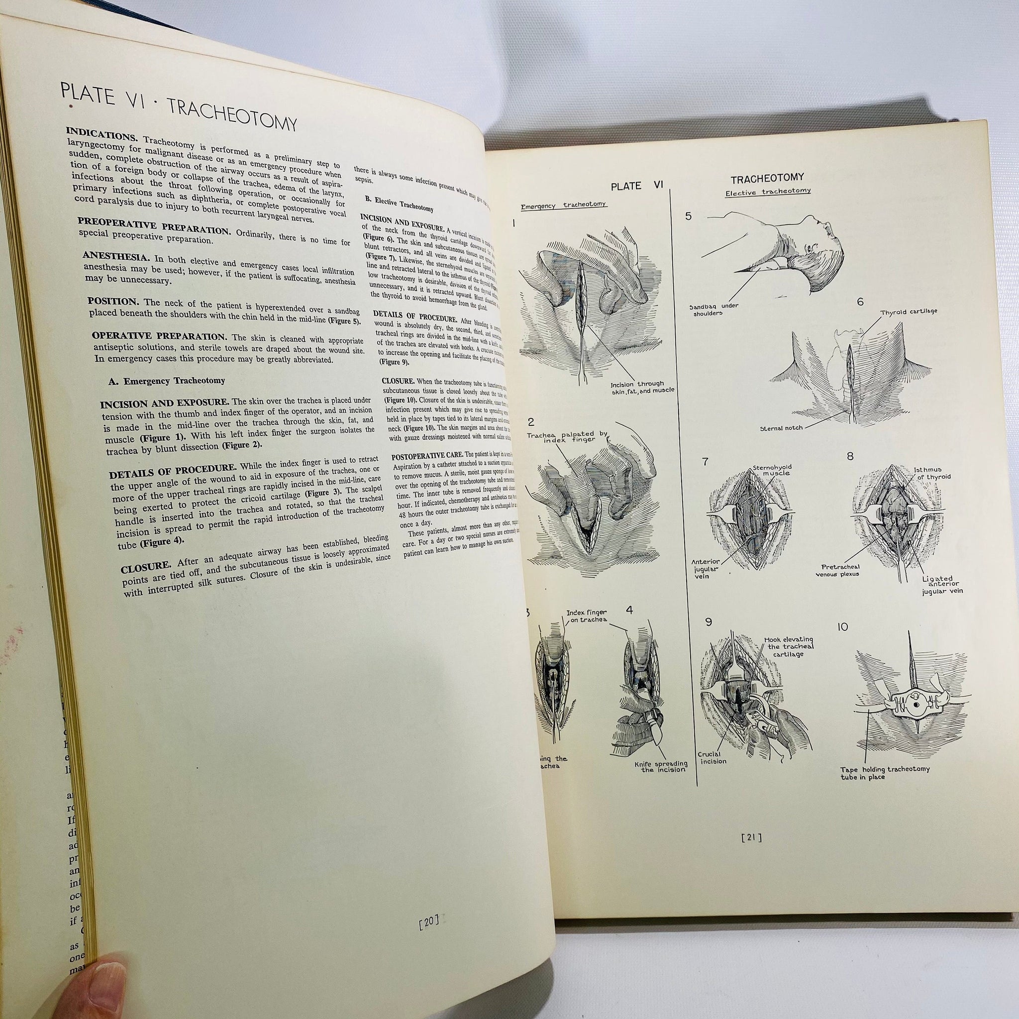 The Atlas of Surgical Operations by Elliot Cutler 1949